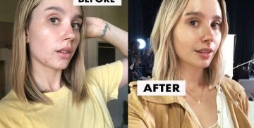 Best High Frequency Facial Machines Review Guide For 2021-2022